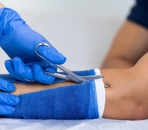 Two hands wearing blue doctor’s gloves, scissors, plaster cast on a patient’s arm being cut open